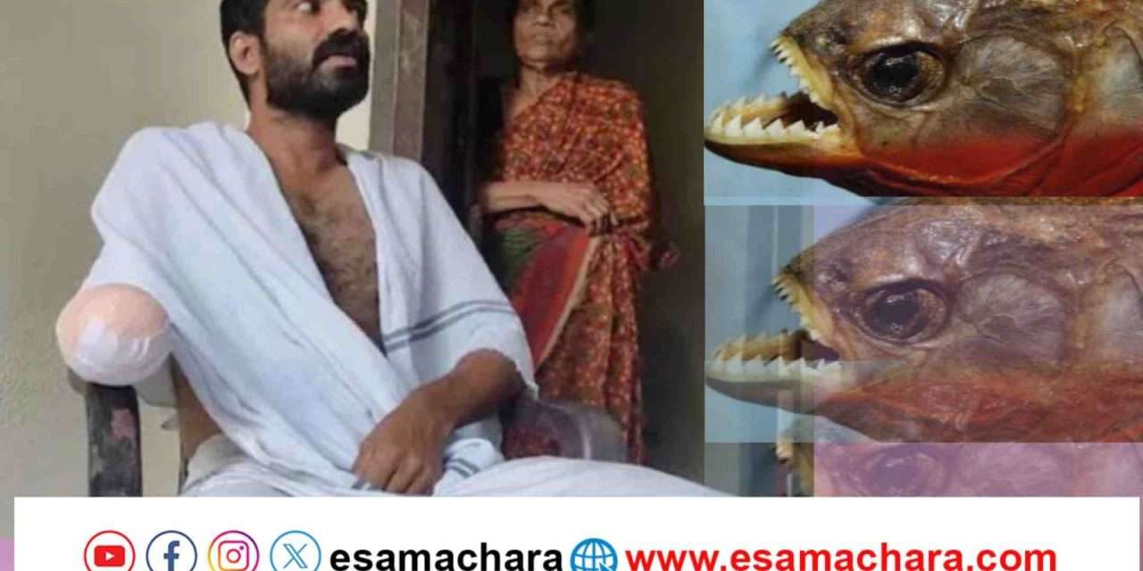Fish Bite/ ಮೀನು ಕಚ್ಚಿದ ಪರಿಣಾಮ ಕೈ ಕಳೆದುಕೊಂಡ ವ್ಯಕ್ತಿ.