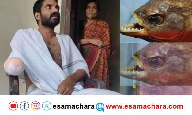 Fish Bite/ ಮೀನು ಕಚ್ಚಿದ ಪರಿಣಾಮ ಕೈ ಕಳೆದುಕೊಂಡ ವ್ಯಕ್ತಿ.