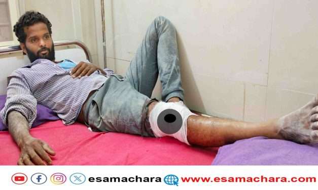 Monkey Attack/ ಕಾರ್ಮಿಕನ ಕಾಲಿಗೆ ಕಚ್ಚಿ ಗಾಯಗೊಳಿಸಿದ ಕೋತಿ.  ಗಂಭೀರ ಗಾಯಗೊಂಡು ಆಸ್ಪತ್ರೆಗೆ ದಾಖಲು